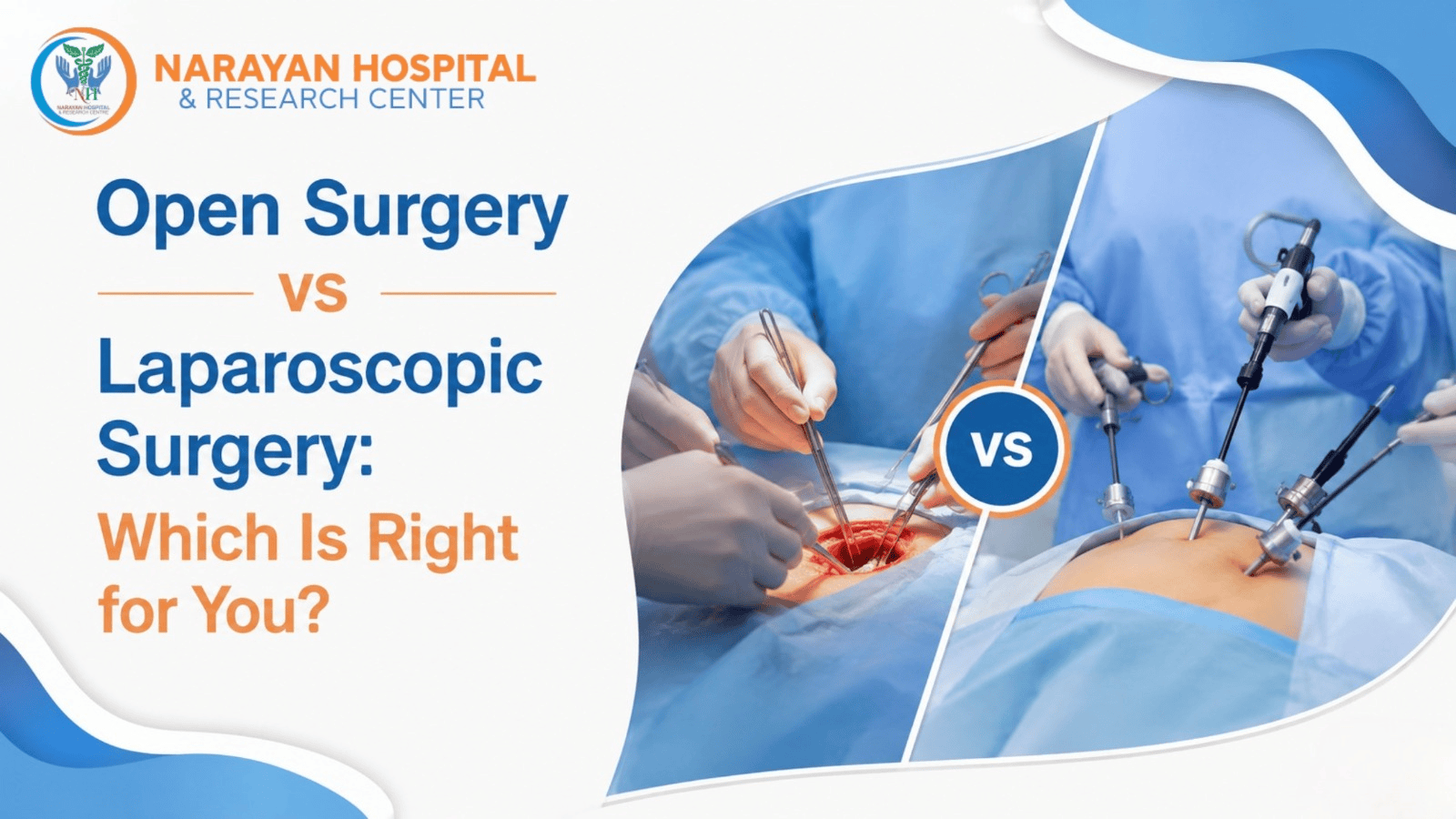 Open Surgery vs Laparoscopic Surgery: Which Is Right for You?